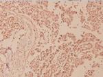 Phospho-NFkB p100 (Ser870) Polyclonal Antibody