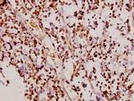 Phospho-p21 (Thr145) Antibody in Immunohistochemistry (Paraffin) (IHC (P))