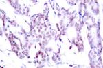 Phospho-STAT6 (Thr645) Antibody in Immunohistochemistry (Paraffin) (IHC (P))