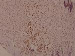 Phospho-Syk (Tyr525) Polyclonal Antibody