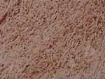 Phospho-Synaptotagmin 1/2 (Thr202, Thr199) Antibody in Immunohistochemistry (Paraffin) (IHC (P))