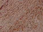 Phospho-Synaptotagmin 1/2 (Thr202, Thr199) Polyclonal Antibody