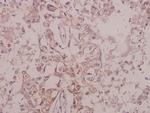 Phospho-TrkB (Tyr516) Antibody in Immunohistochemistry (Paraffin) (IHC (P))