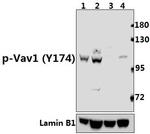 Phospho-VAV1 (Tyr174) Antibody in Western Blot (WB)