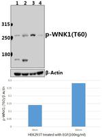Phospho-WNK1 (Thr60) Antibody in Western Blot (WB)