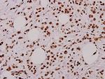 Phospho-Caspase 9 (Thr125) Antibody in Immunohistochemistry (Paraffin) (IHC (P))