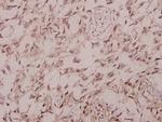 Phospho-IRS1 (Ser1101) Antibody in Immunohistochemistry (Paraffin) (IHC (P))