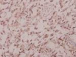 Phospho-IRS1 (Ser1101) Antibody in Immunohistochemistry (Paraffin) (IHC (P))
