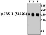 Phospho-IRS1 (Ser1101) Antibody in Western Blot (WB)