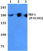 Phospho-IRS1 (Ser1101) Antibody in Western Blot (WB)