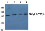 Phospho-PLCG2 (Tyr753) Antibody in Western Blot (WB)