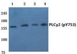 Phospho-PLCG2 (Tyr753) Antibody in Western Blot (WB)