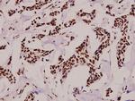 Phospho-POLR2A (Ser1619) Polyclonal Antibody