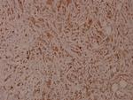 Phospho-ITGB1 (Thr788) Antibody in Immunohistochemistry (Paraffin) (IHC (P))
