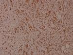 Phospho-ITGB1 (Thr788) Polyclonal Antibody
