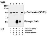 Phospho-Calnexin (Ser583) Antibody in Immunoprecipitation (IP)