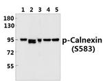 Phospho-Calnexin (Ser583) Antibody in Western Blot (WB)