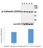 Phospho-Calnexin (Ser583) Antibody in Western Blot (WB)