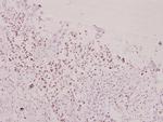 Phospho-FOXO1/FOXO3/FOXO4 (Thr24, Thr32) Antibody in Immunohistochemistry (Paraffin) (IHC (P))