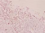 Phospho-FOXO1/FOXO3/FOXO4 (Thr24, Thr32) Polyclonal Antibody