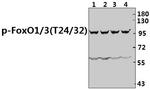 Phospho-FOXO1/FOXO3/FOXO4 (Thr24, Thr32) Antibody in Western Blot (WB)