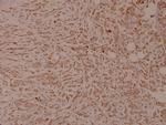 Phospho-INSR (Tyr1355) Polyclonal Antibody