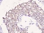 Phospho-IRS1 (Ser323) Polyclonal Antibody