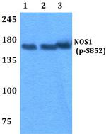 Phospho-nNOS (Ser852) Antibody in Western Blot (WB)