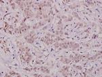 Phospho-Bcl-X (Thr47) Polyclonal Antibody