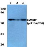 Phospho-CaMKIV (Thr196, Thr200) Antibody in Western Blot (WB)