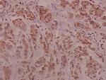 Phospho-IRS1 (Ser794) Polyclonal Antibody