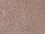 Phospho-MiTF (Ser180) Polyclonal Antibody