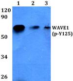 Phospho-WAVE1 (Tyr125) Antibody in Western Blot (WB)
