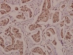 Phospho-PPAR gamma (Ser112) Polyclonal Antibody