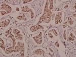 Phospho-PPAR gamma (Ser112) Polyclonal Antibody