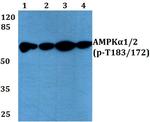 Phospho-AMPK alpha-1,2 (Thr172, Thr183) Antibody in Western Blot (WB)