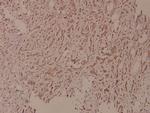 Phospho-PLCG1 (Tyr771) Antibody in Immunohistochemistry (Paraffin) (IHC (P))