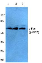 Phospho-c-Fos (Ser362) Antibody in Western Blot (WB)