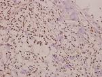 Phospho-SMAD1 (Ser465) Polyclonal Antibody