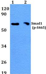 Phospho-SMAD1 (Ser465) Antibody in Western Blot (WB)