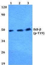 Phospho-IkB beta (Thr19) Polyclonal Antibody
