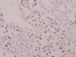 Phospho-p47phox (Ser304) Antibody in Immunohistochemistry (Paraffin) (IHC (P))