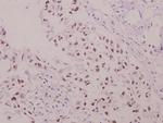 Phospho-p47phox (Ser304) Polyclonal Antibody