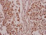 Phospho-PKC delta (Ser645) Polyclonal Antibody