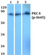 Phospho-PKC delta (Ser645) Antibody in Western Blot (WB)