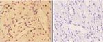 Phospho-AKT Pan (Tyr315, Tyr316, Tyr312) Polyclonal Antibody