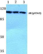 Phospho-Androgen Receptor (Tyr363) Antibody in Western Blot (WB)