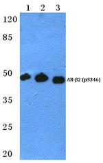 Phospho-beta-2 Adrenergic Receptor (Ser346) Polyclonal Antibody