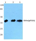 Phospho-CK1 alpha (Thr321) Polyclonal Antibody