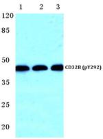 Phospho-FCGR2B (Tyr292) Polyclonal Antibody